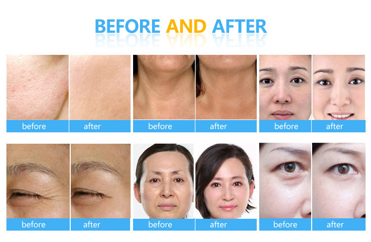 skin spa system H600D_3.jpg